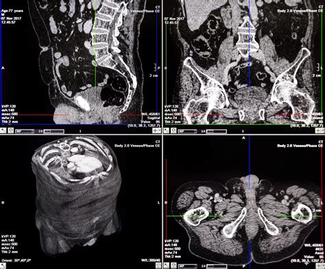 what is a ct return.